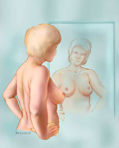 Breast Self Examination