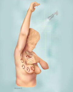 Breast Self Examination